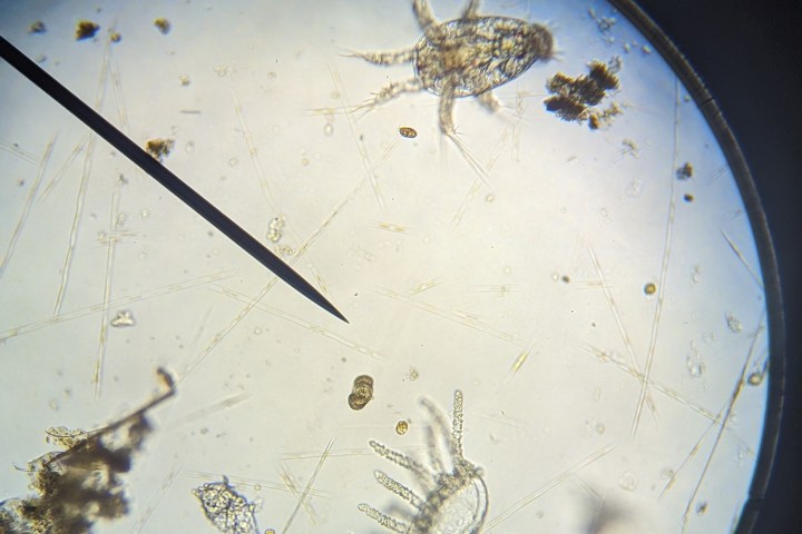 crustaceans under a microscope